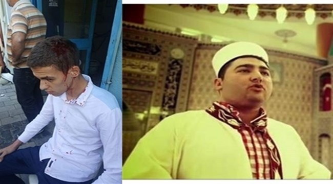 Çanakkale’de Bu Sefer İmam Bayılttı