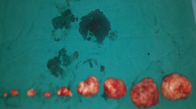 Rahminden 1 kiloluk ur çıktı