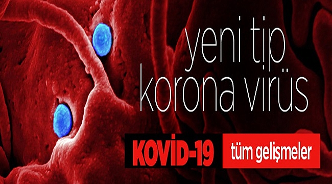Kovid-19 vakalarında immün plazma tedavisi umut vadediyor