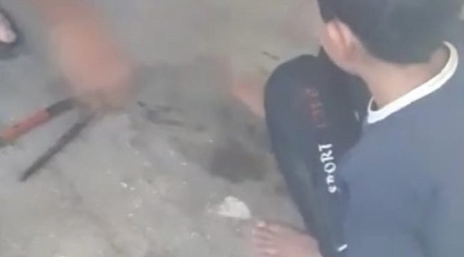 Bursa'da ayağından zincirlenmiş bir çocuk evinde çıkan yangından kurtarıldı