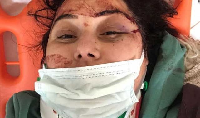 Kordon boyunda yürürken motosiklet çarptı