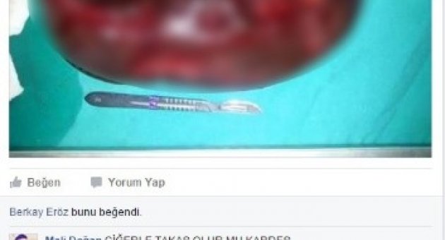 Acil Satılık Dalak Böbrek