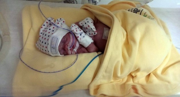 Bursa’da Yaşamaz Denilen Parmak Bebek Görenleri Şaşırtıyor