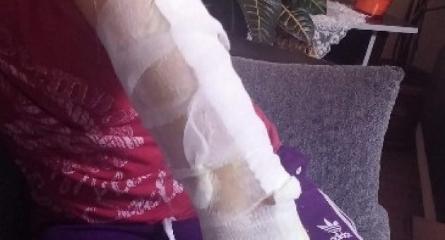 Edremit’te Hıdrelez Ateşi Genci Az Daha Yakıyordu