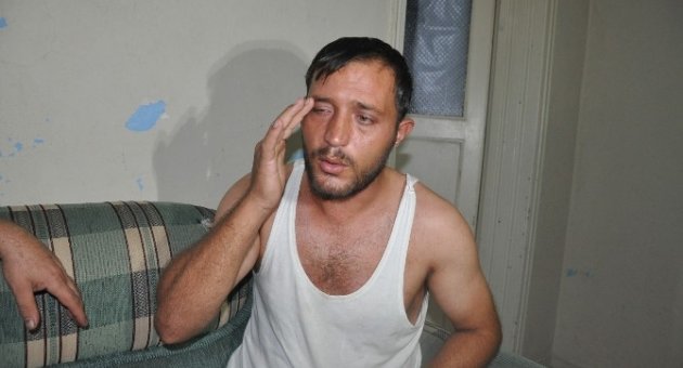 Işid’in Kimyasal Bombasına Maruz Kalan Suriyeli Aile