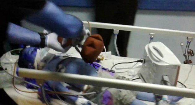 Kamyonetin Çarptığı Küçük Kız Hayatını Kaybetti