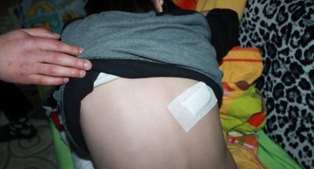 (özel Haber) Bursa’da Pitbull Dehşeti