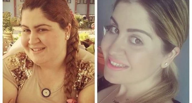 (özel Haber) İzmirli Sinem Tüp Mide Ameliyatıyla 55 Kilo Verdi