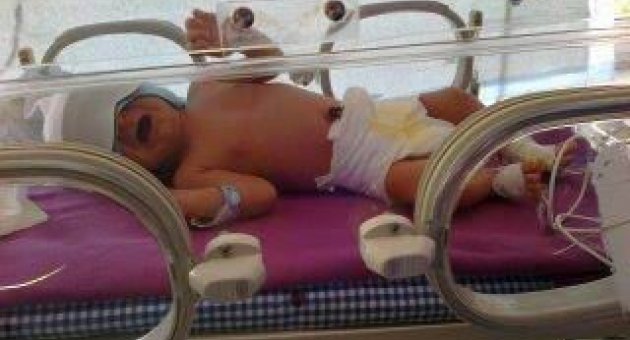 (özel Haber) Küçük Çocuğa Evde Yoğun Bakım