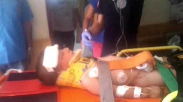 İkinci Kattan Düşen Küçük Çocuk Ağır Yaralandı